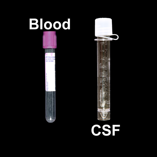 IU Health Lab Test Directory Tests