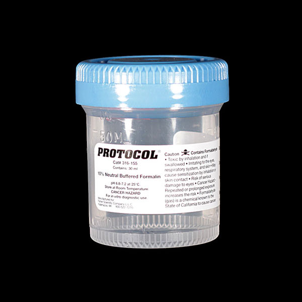 IU Health Lab Test Directory Tests