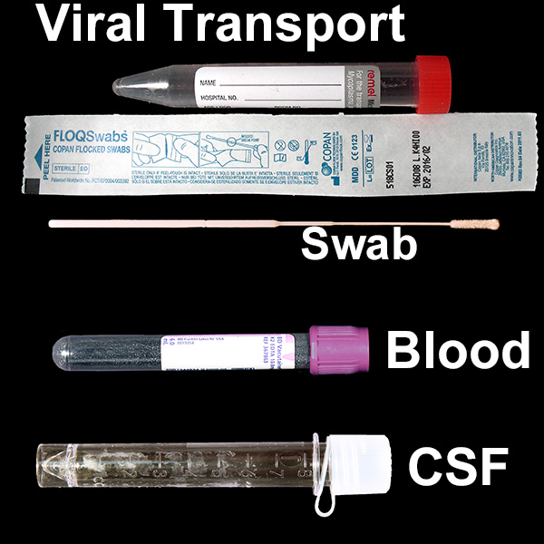 IU Health Lab Test Directory Tests
