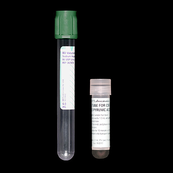 IU Health Lab Test Directory Tests