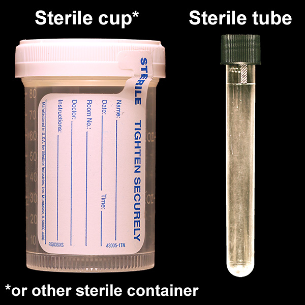 IU Health Lab Test Directory Tests