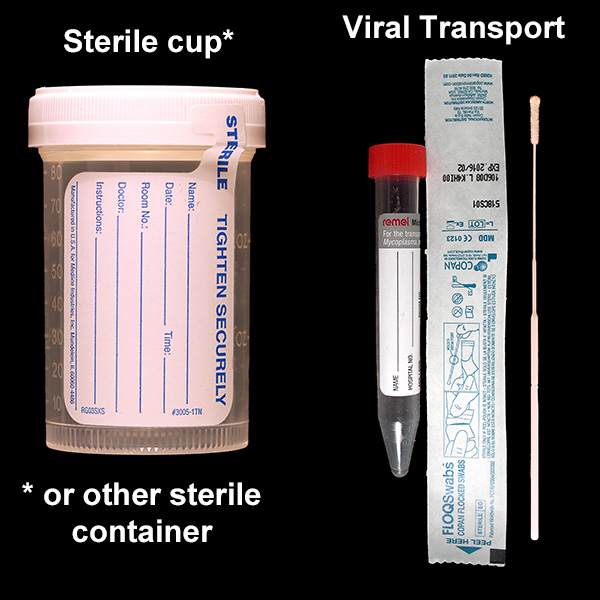 IU Health Lab Test Directory Tests