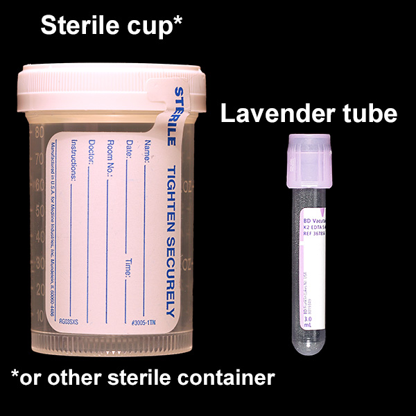 IU Health Lab Test Directory Tests